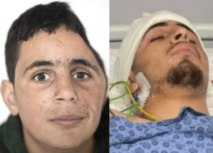 Mohammad Tamimi, (L) age 15, after having 1/3 of his skull removed; age 20, after assassination attempt.