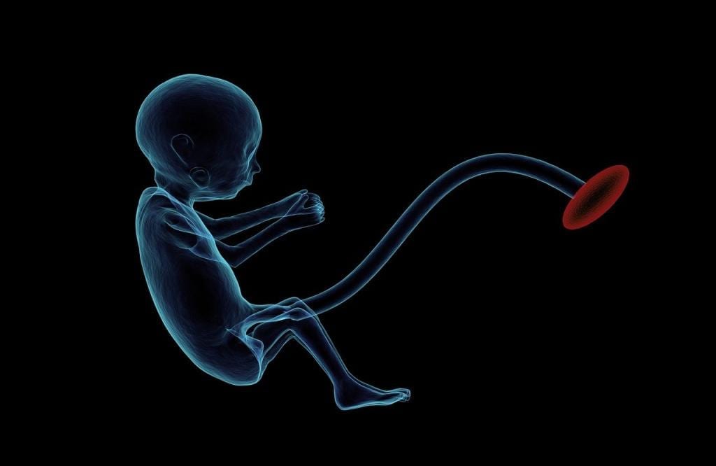 Pro-life or anti-abortion image