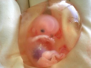 Human fetus 10 weeks with amniotic sac