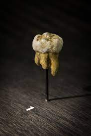 tooth