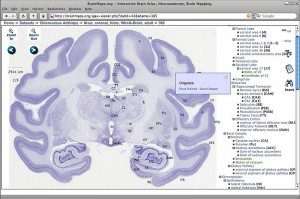 A "brain map," in purple
