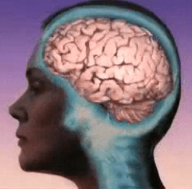 Female brain, side view