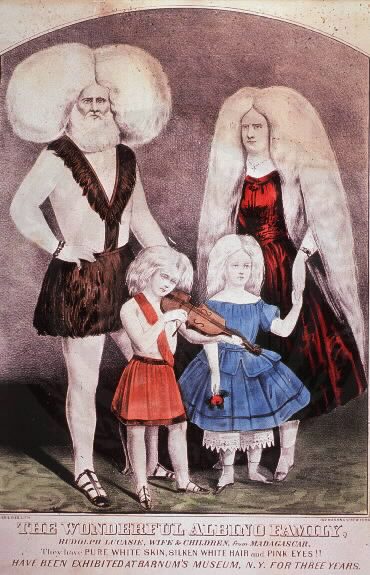 An albino family