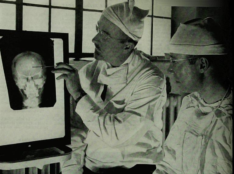 Original caption: "Dr. Walter Freeman, left, and Dr. James W. Watts study an X ray before a psychosurgical operation. Psychosurgery is cutting into the brain to form new patterns and rid a patient of delusions, obsessions, nervous tensions and the like." from Saturday Evening Post 1941, pages 18-19. Photo Source Wikimedia Commons. Public Domain. 