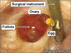 ovulation