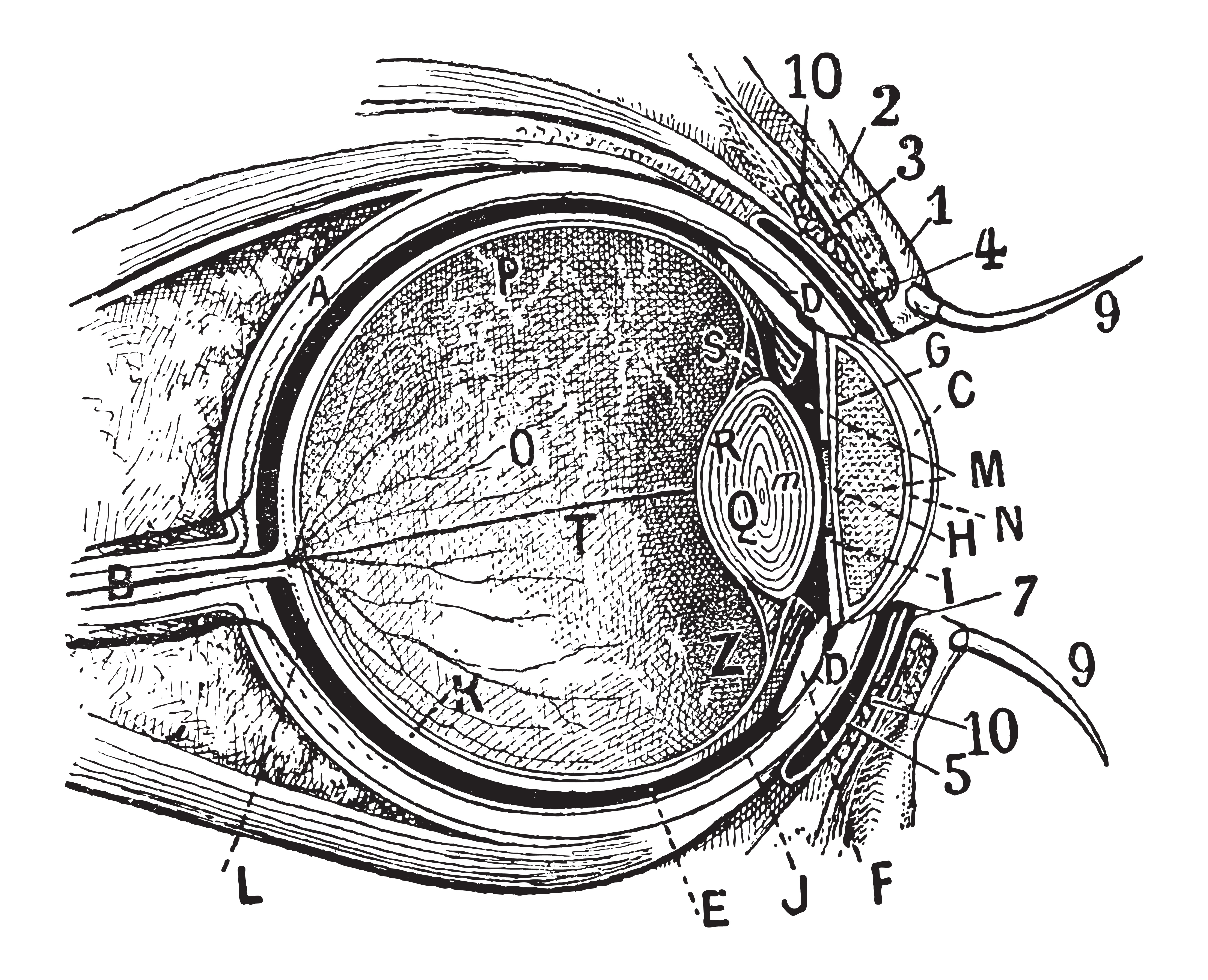 Царапины роговицы глаза офтальмология