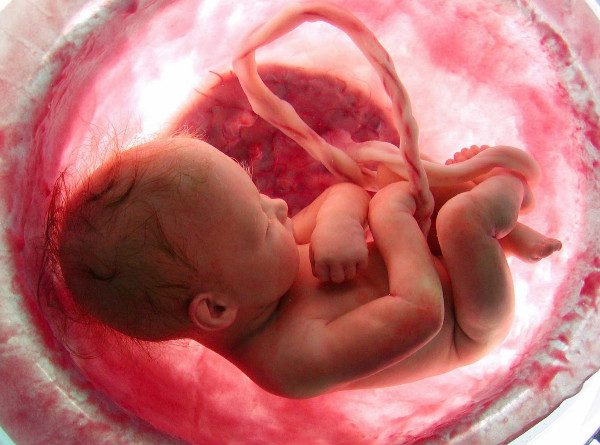 Image of child in womb from Abortion story via CNN.com