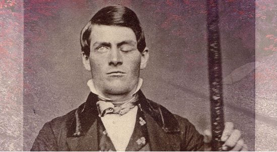 Biblical counselors know that Phineas Gage suffered from a spiritual ailment and not, as secular, therapeutic "doctors" claimed, from having a 3-foot iron rod pass through his skull.