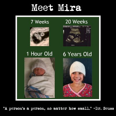 Why I Am Pro-Life | Mere Breath