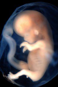 Embryo9-10weeks