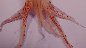 Tentacles. They're kind of gross and fascinating.  [photo credit: Public domain, via Wikimedia Commons] 