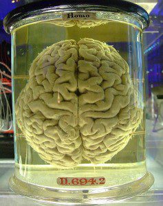 https://en.wikipedia.org/wiki/File:Human_brain_in_a_vat.jpg