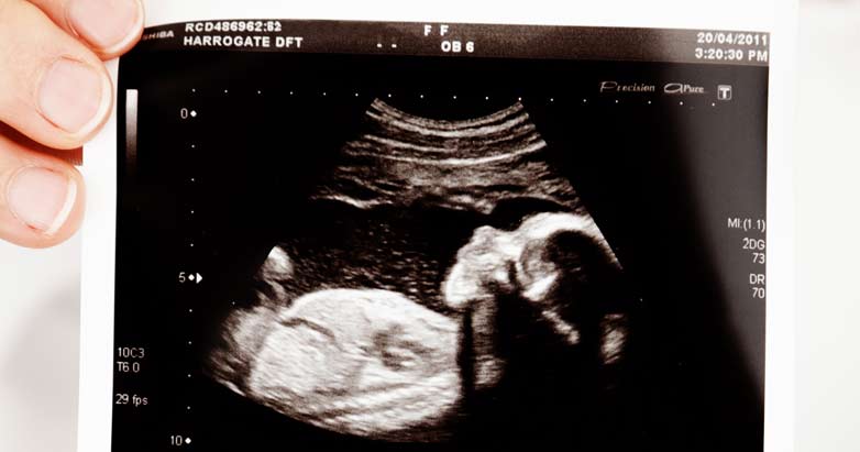hold-ultrasound-fetus-shapiro-patheos