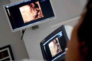 a screen with an ultrasound display of an unborn baby in the third trimester of pregnancy