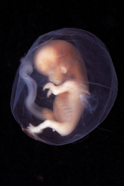 Image Source: Embryo Week 9-10 by Lunar Caustic; CC 2.0