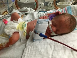 Grayson in his NICU bed