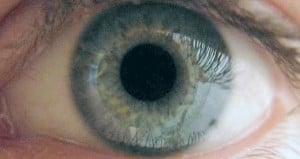 Eye