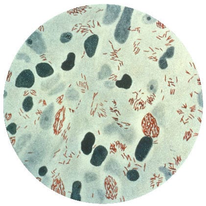 Mycobacterium leprae bacteria  (Public Domain)
