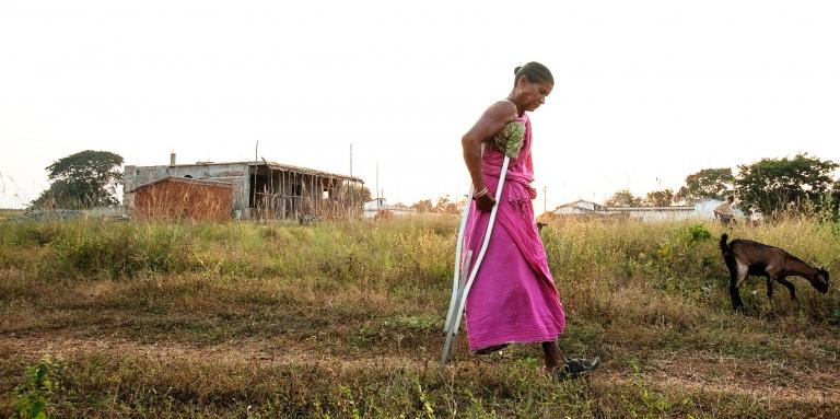 Leprosy is Curable—But Still Feared - KP Yohannan - Gospel for Asia