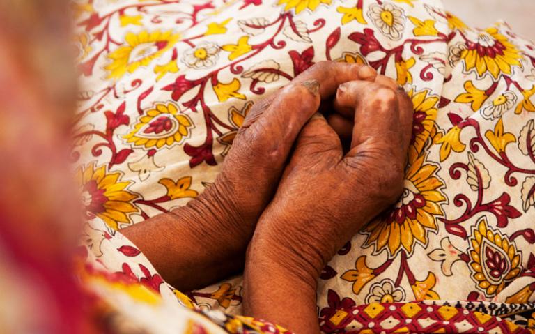 The deformed hands of leprosy patients—and the stigma that surrounds the disease—limit job opportunities.