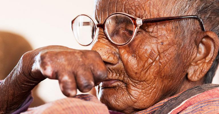 The physical disfigurement caused by leprosy is one of the most well-known signs of the disease.