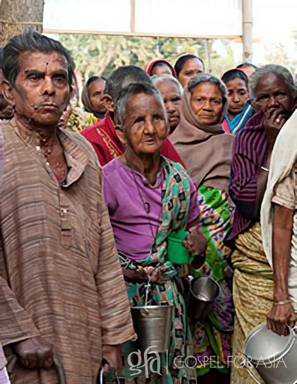 Gospel for Asia (GFA World) founded by Dr. K.P. Yohannan: Discussing the stigma of having leprosy, the suffering, humiliation, and the love of Christ shown through those like a Gospel for Asia missionaries.