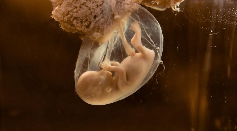 Is A 15-Week Abortion Ban Actually Pro-Choice? - Vimarsana News