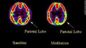 Can Meditation Change Your Brain Contemplative Neuroscientists Believe It Can