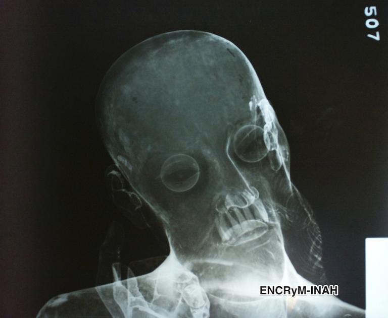 x-ray-jesus