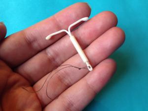 A Mirena IUD in a hand (Sarah Mirk CC BY-NC 2.0 https://www.flickr.com/photos/mirkmirk/31140095680/)