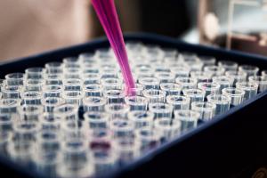 Lab testing vials (CC0 Louis Reed on Unsplash)