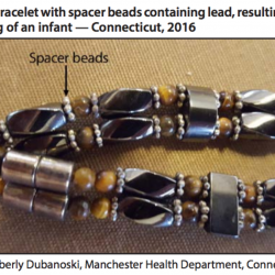 A Homeopathic Bracelet Gave an Infant Lead Poisoning, Says the CDC