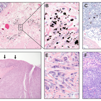 Is the News of a New Organ in the Human Body “Unproven and Probably False”?