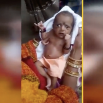 An Indian Baby Born With Three Hands Is Supposedly Being “Worshipped as a God”